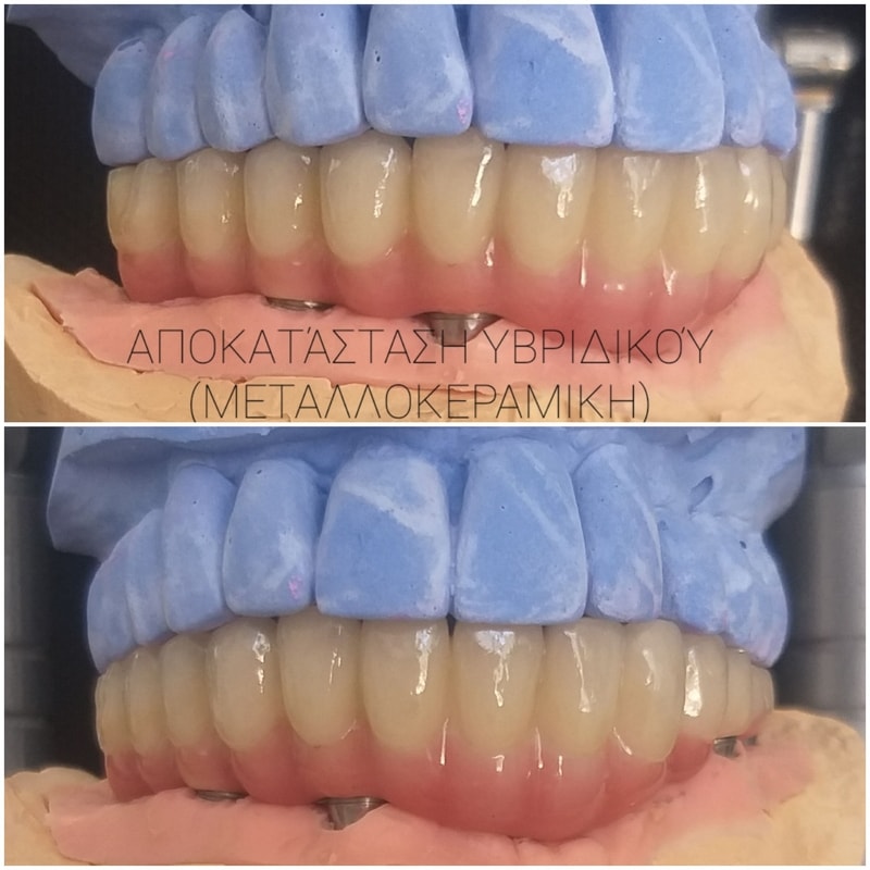 toothlab peristatiko