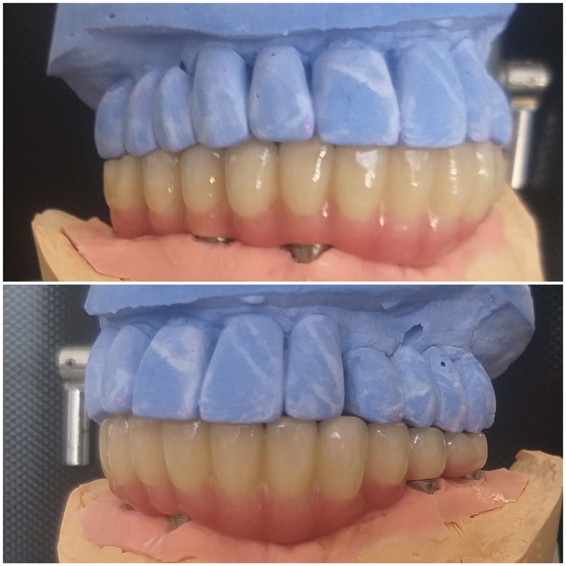 toothlab peristatiko
